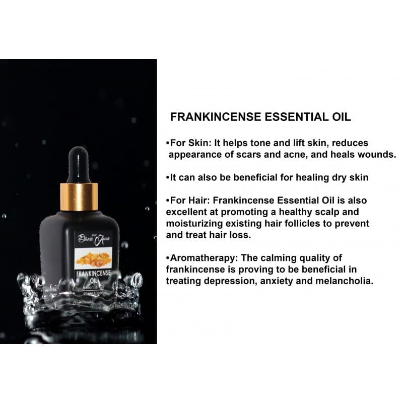Frankincense oil
